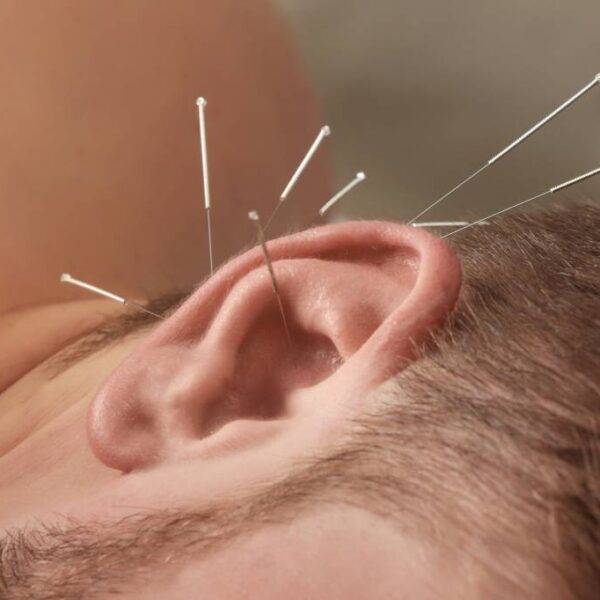 ear seeds acupuncture alternative