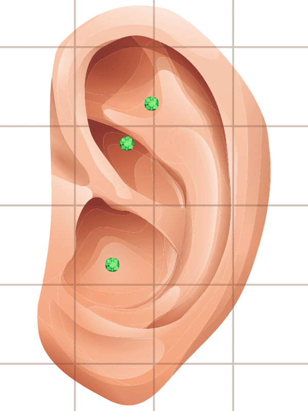Depression Ear Seed Placement Chart