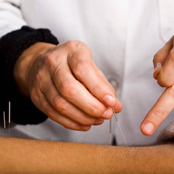 Alternative and Complementary Health Professionals - acupuncturist