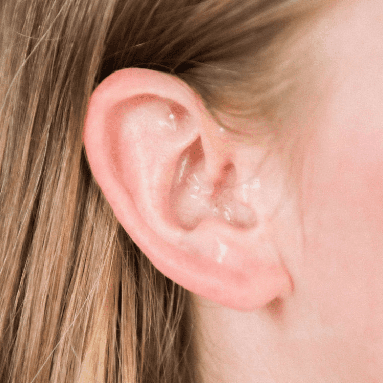 ear seeds on an ear