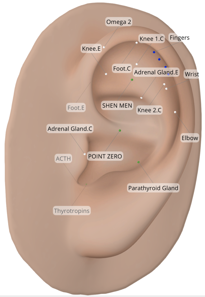 Where to place ear seeds for arthritis - osteoarthritis