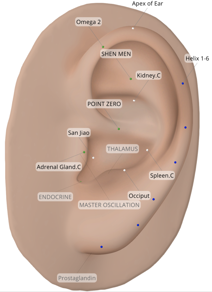 Where to place ear seeds for arthritis - rheumatoid